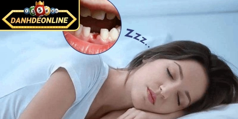 Mơ thấy rụng răng cửa có ý nghĩa ra sao?